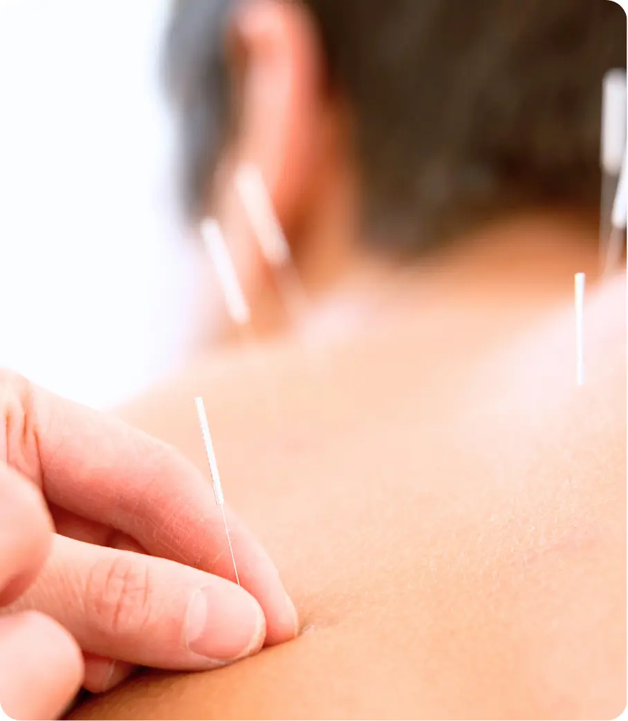 Accupuncture and bodywork